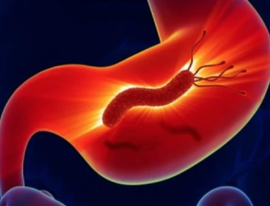 Έλκος στομάχου: Η κατάλληλη διατροφή – Τι να τρώτε και τι να αποφεύγετε